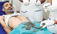 2 மாதம்... 40 கத்தியை விழுங்கிய பஞ்சாப் போலீஸ்காரர்...